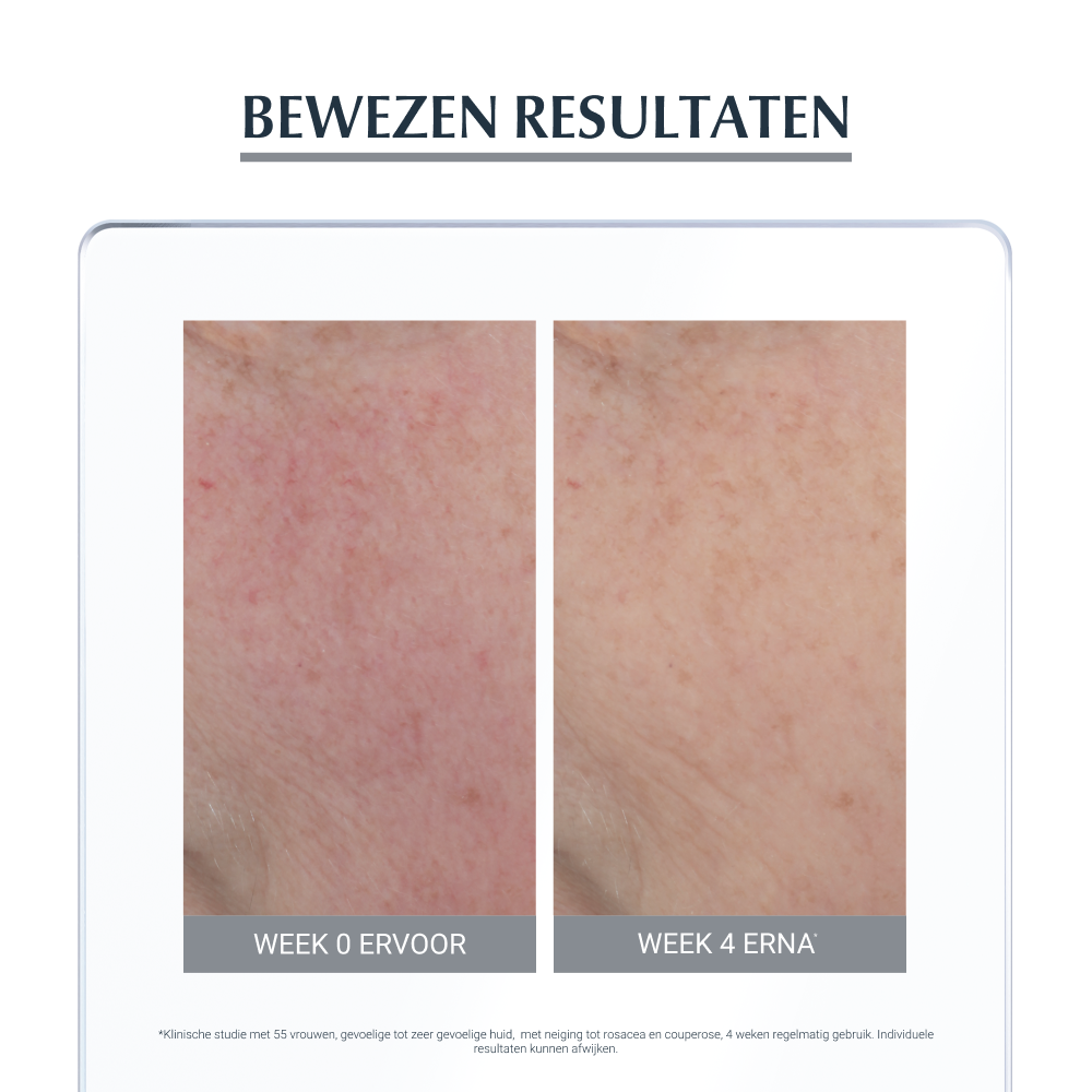 AntiREDNESS Corrigerende Crème 50 ml