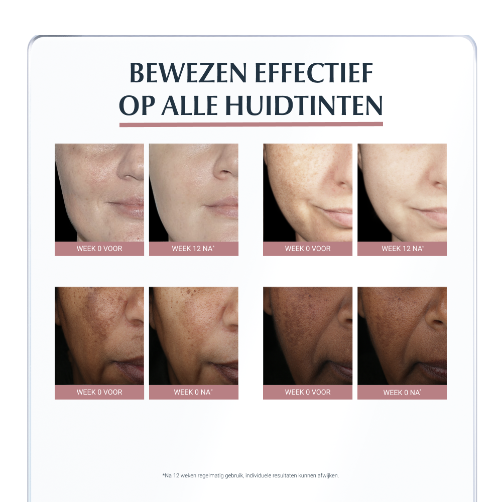 Anti-Pigment Spot Corrector 5 ml